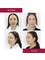 CORAMED Beauty Surgery - Nose correction in combination with a chin implant. This is a fascinating combination of two treatments that can significantly improve the proportions of the face and emphasize its beauty. 