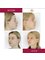 CORAMED Beauty Surgery - Complete nose correction, he models the bone part, i.e. the skeleton of the nose - it is professionally called osteotomy and the cartilage part - the tip of the nose, wings and holes. 