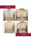 CORAMED Beauty Surgery - Have you ever wondered how much change breast augmentation surgery can bring?  