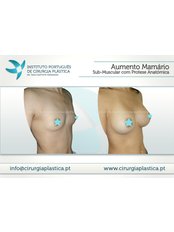 Breast Implants - Up Clinic