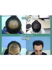 Plastic Surgeon Consultation - Hair Implant Institute