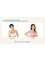 Girin Plastic Surgery - Breast Augmentation 