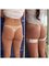 LaCLINIQUE of Switzerland - Lugano - Gluteal Reshaping 8 