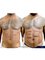 Dr. Chakarin Plastic Surgery - Abdominal Etching also known as Six Pack Abs Surgery performed by Dr. Chakarin Suchakaro. For more info you may call the following number: Line ID : @358yxtxr Call : 065-915-2962 | +66-65-915-2959 | +66-64-945-2594 (Arabic) 