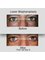 Dr Siripong Surgery - Eye Bag Removal 