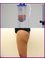 The Sib Clinic - Vaser liposuction legs 