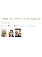 Fat Transfer - The Sib Clinic