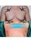 Aspro Atlantic plastic surgery - male breast reduction 