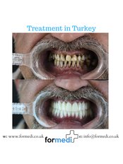 Zirconia Crown - Formedi Clinic Turkey