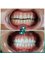 SoracaMed Clinic - Dental Treatment  