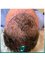 SoracaMed Clinic - Hair Transplant  