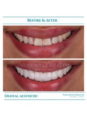 Dental Crowns - Voluntas Health