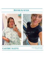 Gastric Sleeve - Voluntas Health