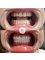 Dr. Görkem Atsal Clinic - #Hollywoodsmile #DentalTreatment 