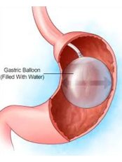 Gastric Balloon - ELBE Aesthetic Clinic