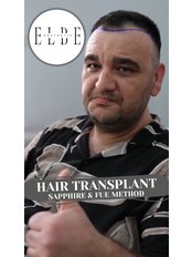 Sapphire Hair Transplant - ELBE Aesthetic Clinic