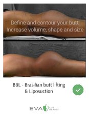 BBL - Brazilian Butt Lift - Eva Life Beauty Clinic