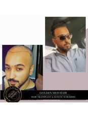 Hair transplant - Golden Med Hair