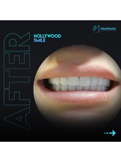 Hollywood Smile - Medworkt Health