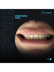 Hollywood Smile - Medworkt Health