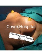 Breast Implant Revision - Private Cevre Hospital