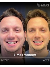Smile Makeover with E-Max Crowns / Veneers - Surgero