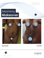 Mommy Makeover - Surgero