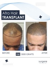 Afro Hair Transplant - Surgero