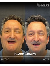 Smile Makeover with Zirconia Crowns / Veneers - Surgero