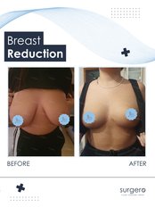 Breast Lift / Reduction - Surgero