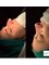 Dr.Ümit Hardal Central Hospital - Rhinoplasty for crooked nose 