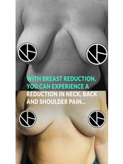 Breast Reduction - Dr. Bora Ok - Aesthetic Plastic Surgery Clinic