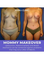 Mommy Makeover - Flora Klinik