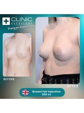 Fat Transfer - Clinic Excellent