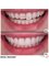SurgeryTR - Istanbul - Dental Treatment 
