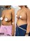 SurgeryTR - Istanbul - Breast Implant, Breast Lift 