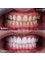 SurgeryTR - Istanbul - Dental Treatment 