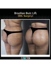 BBL - Brazilian Butt Lift - Clinicton
