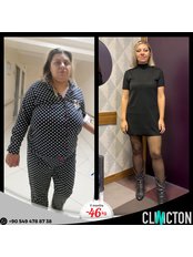 Gastric Bypass - Clinicton
