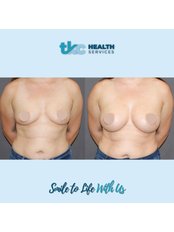 Breast Implants - TKC Health Services