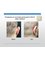 MACS Cosmetic clinic (Watford) - Correction of prominent ears 