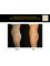 MACS Cosmetic clinic (Watford) - Power assisted liposuction 