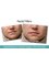 Danik MedSpa and Cosmetic Surgery - Cosmetic Facial Fillers 