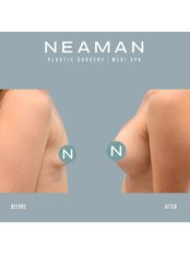 Breast Implants - Neaman Plastic Surgery & Medi Spa