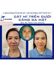 Plastic Surgeon Consultation - Dr. Duong Tran Van Clinic