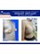 Dr. Duong Tran Van Clinic - Breast Implant 