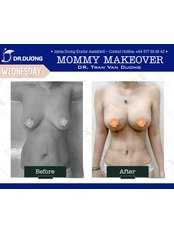 Mommy Makeover - Dr. Duong Tran Van Clinic