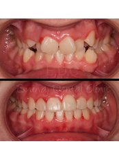 Orthodontics - EDC - Eminaj Dental Clinic
