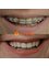 Dental Clinic New Smile - Rruga  Nikolla Tupe, Tirana, Albania, 1019,  4