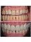 Dental Clinic New Smile - Rruga  Nikolla Tupe, Tirana, Albania, 1019,  32